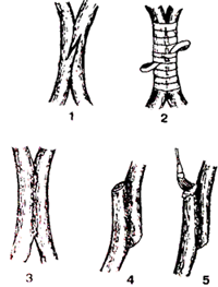 Прививка методом аблактировки